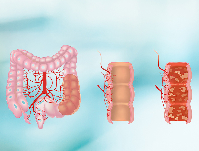 Gastro Conditions – Grover Gastro and Fertility Centre